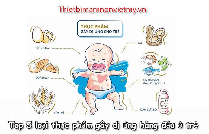 Top 5 Loai Thuc Pham Gay Di Ung Hang Dau O Tre 1 2